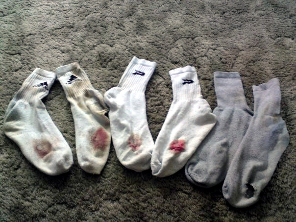 Blood stained socks