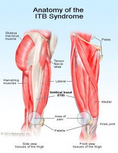 ITB Pain, Runners Knee, Physiotherapy, Muscle Tightness and Joint Injury
